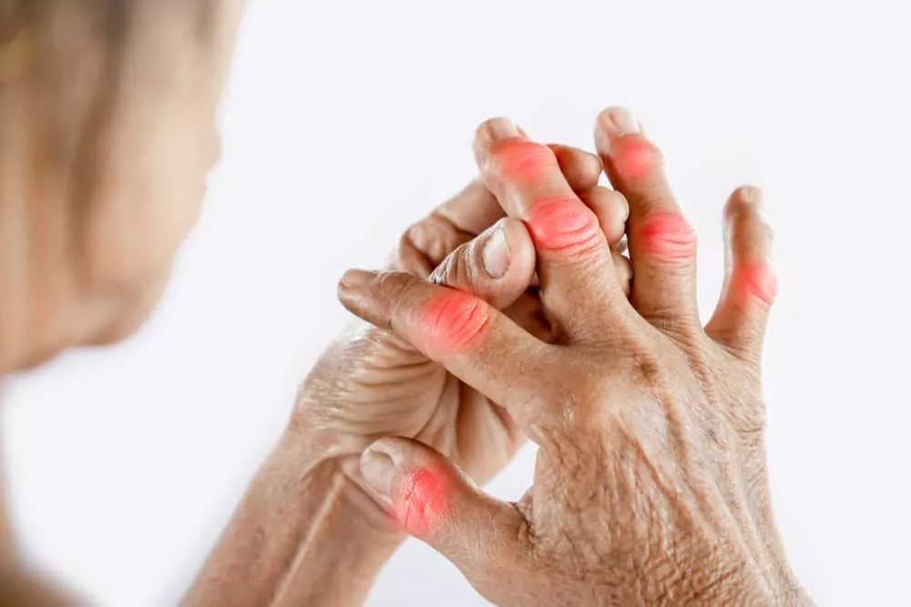 Personne âgée avec de l'arthrose des doigts