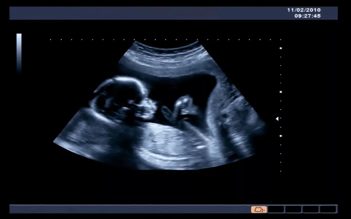 Image de photo de grossesse personnalisée par échographie pour bébé