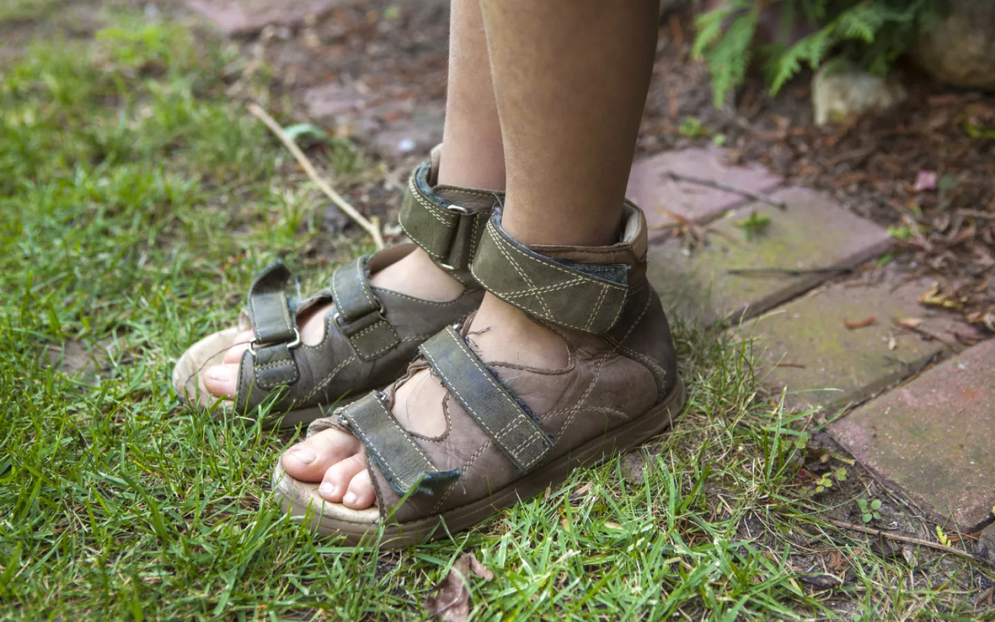 Santiane - Remboursement des chaussures orthopédiques