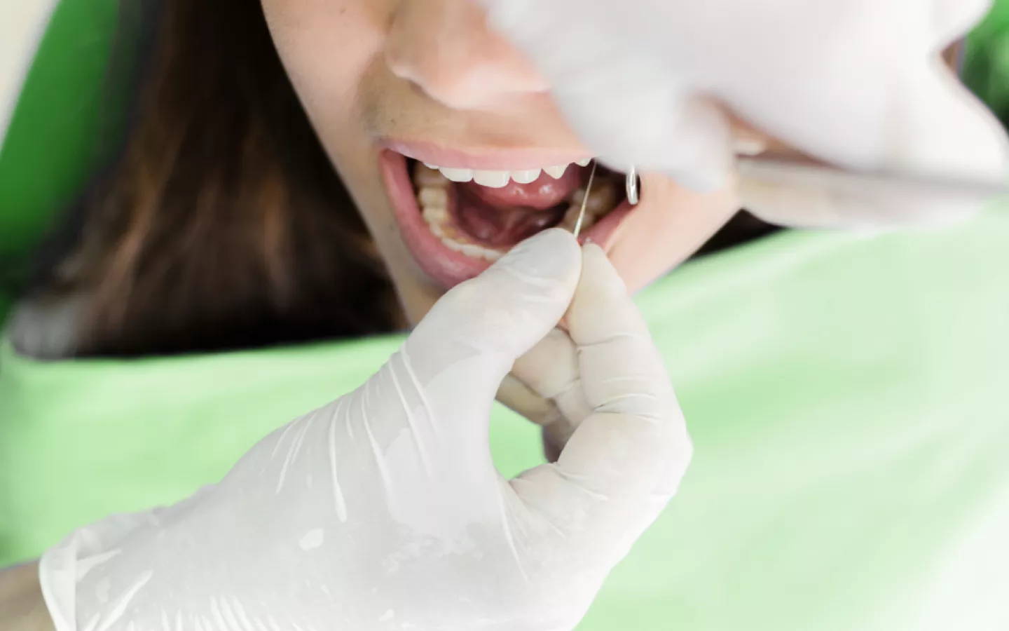 Une jeune femme se fait dévitaliser une dent
