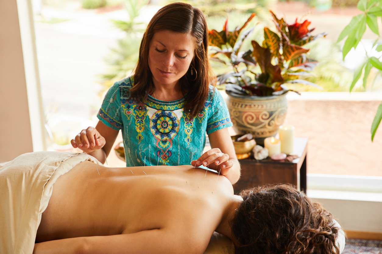 Le remboursement de l’acupuncture