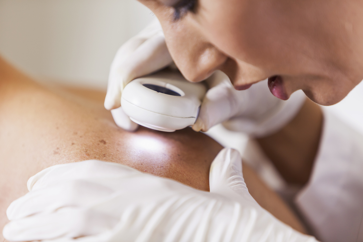 Le remboursement de la dermatologie