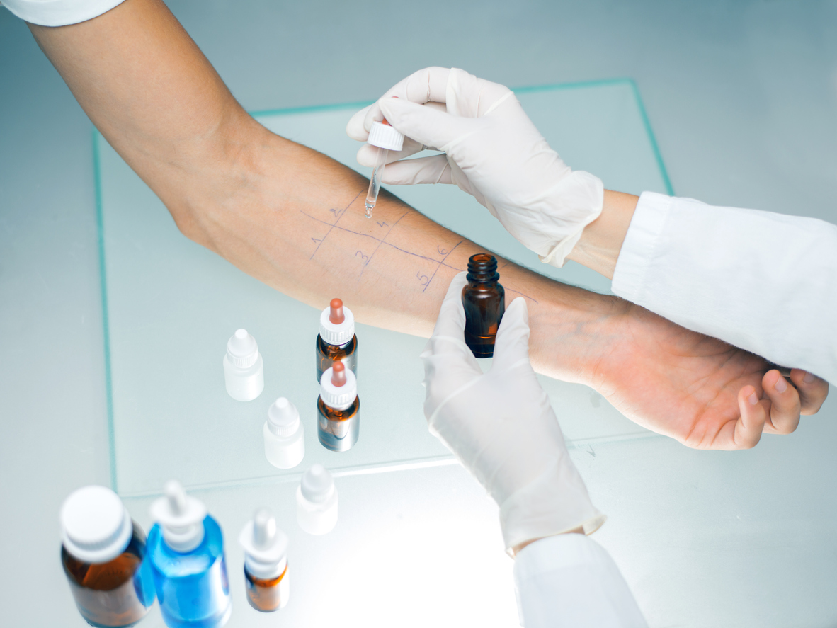 Quel remboursement pour le traitement des allergies ?