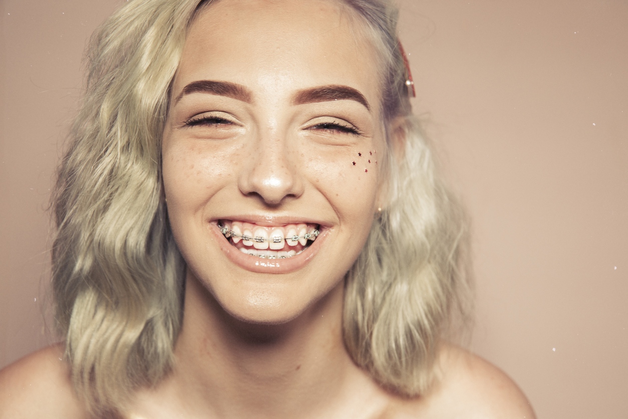 Traitement d’orthodontie adulte et enfant : quels remboursements ?